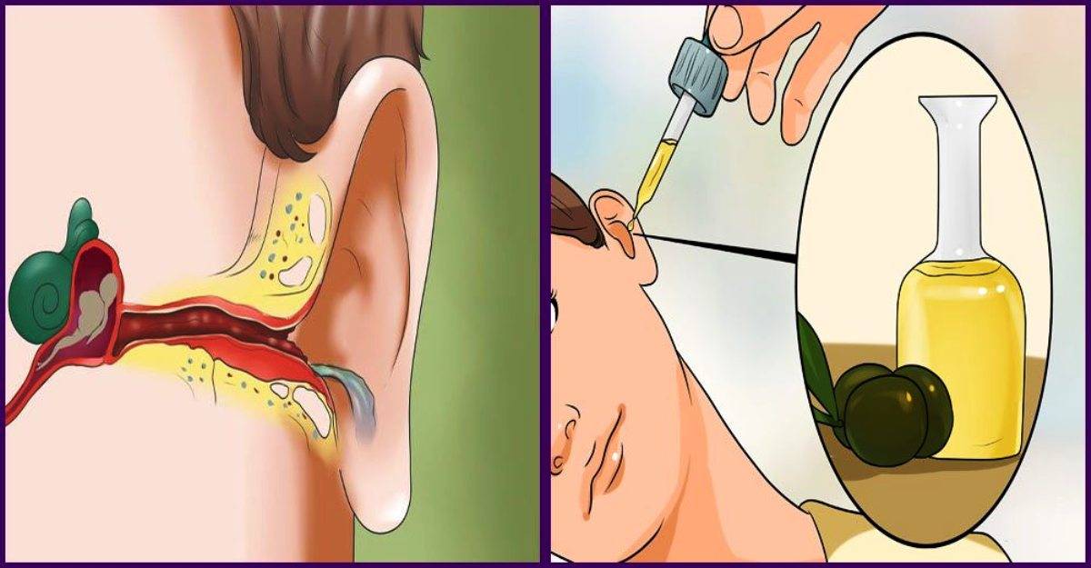 Что делать если болит ухо