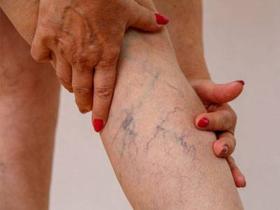Покалывание в руках и ногах причины лечение народными средствами