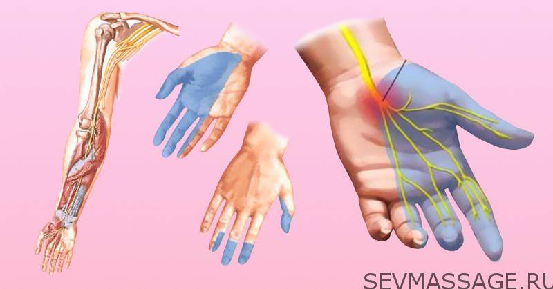 Отчего немеют пальцы рук и ног: причины и лечение онемения пальцев верхних и нижних конечностей