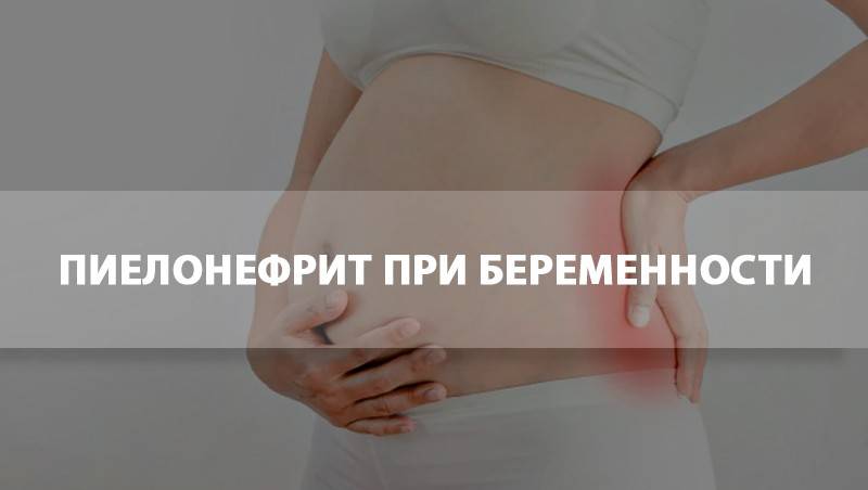 Пиелонефрит при беременности (на разных ее сроках) и грудном вскармливании: формы заболевания, симптомы и лечение, возможные последствия и другие аспекты