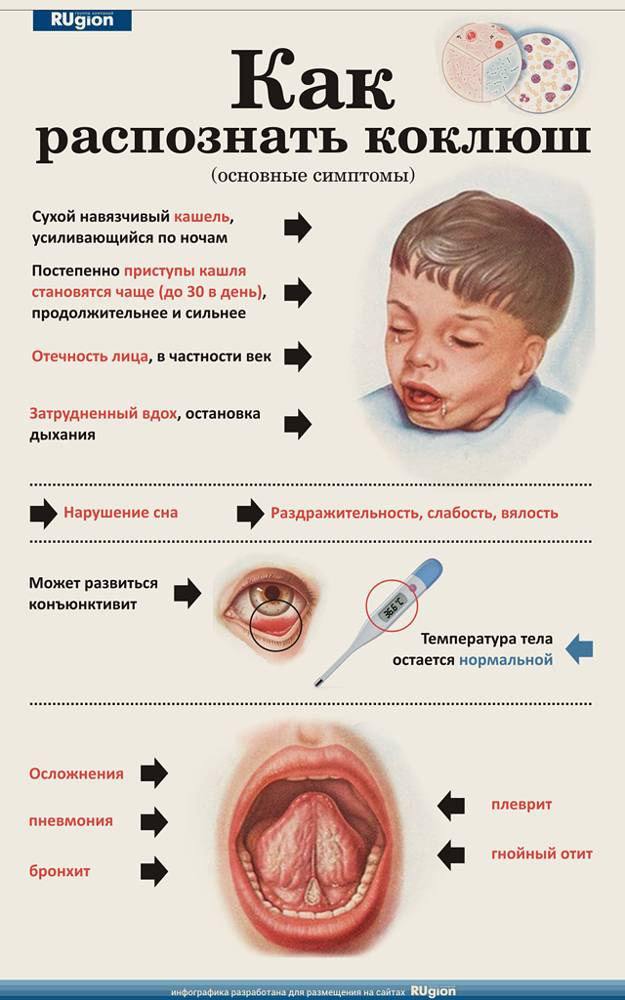 Псевдококлюш симптомы у детей лечение