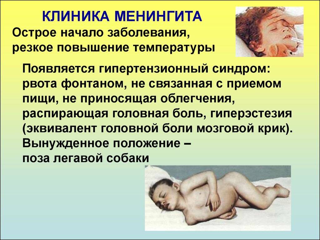 Серозный менингит у детей: симптомы, инкубационный период, лечение