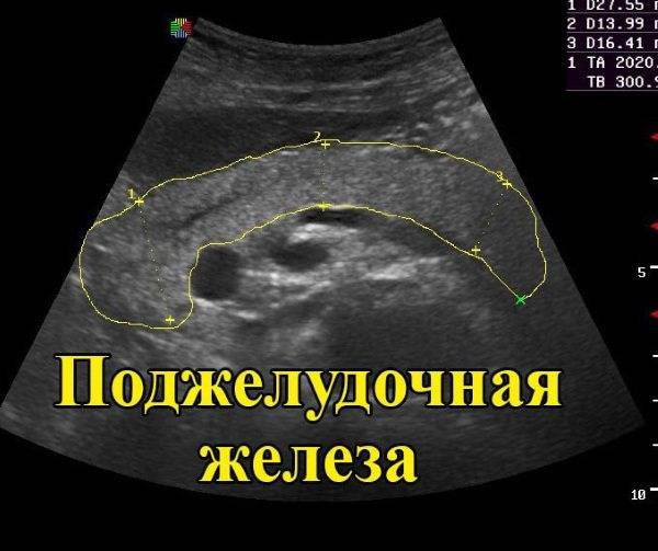 Поджелудочная железа: симптомы заболевания, диета и лечение. устранение причины боли народными средствами, а также питание при воспалении и кисте