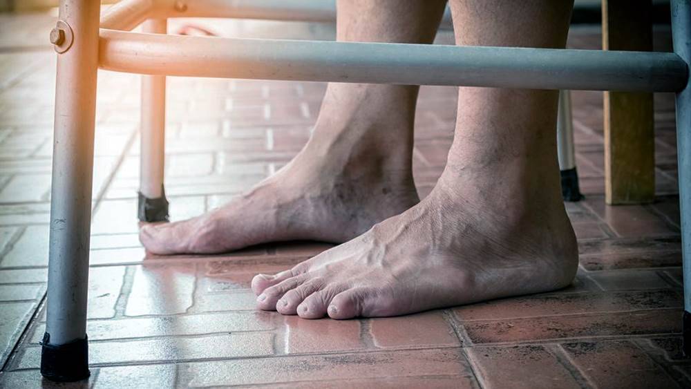 Судороги ног у пожилых людей причины, лечение