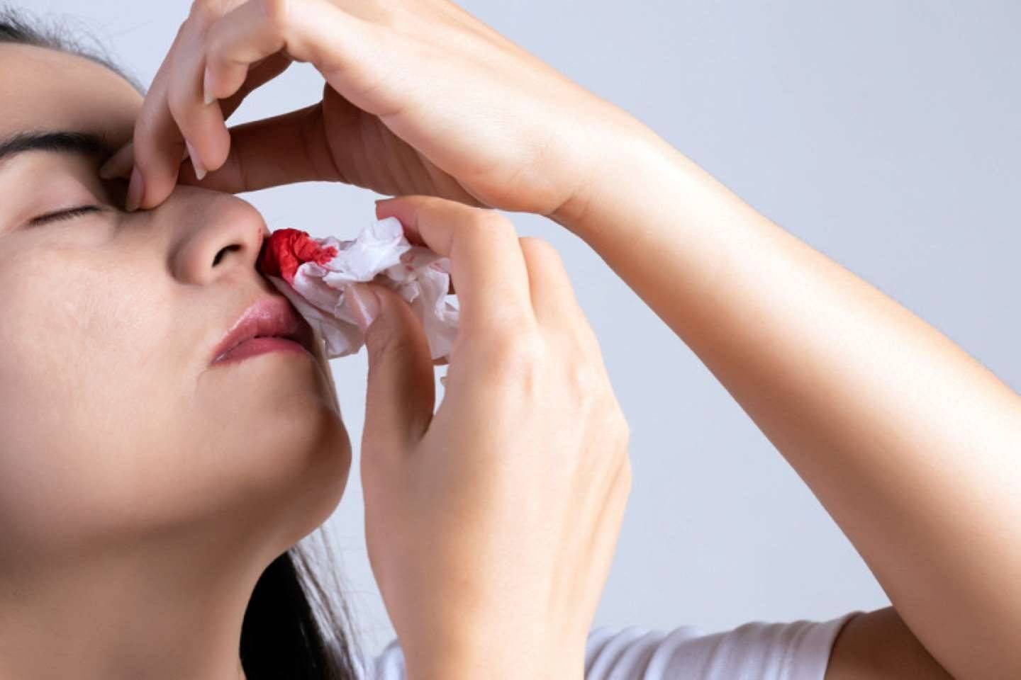 Кровь из носа: отчего при простуде и насморке течет кровь