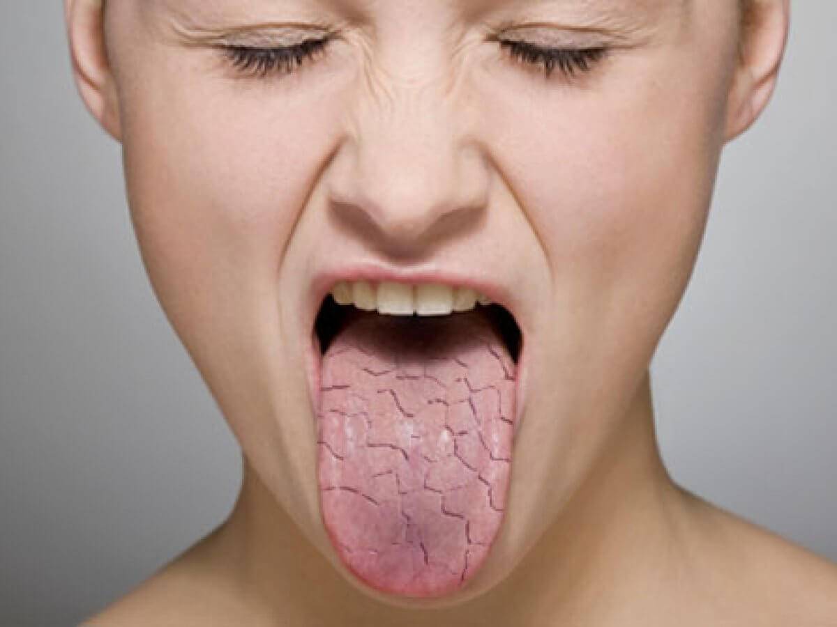 Горечь и сухость во рту: причины, лечение, симптомы