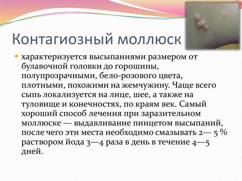 Контагиозный моллюск у детей: фото, симптомы и лечение в домашних условиях