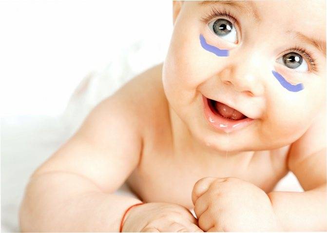 Круги под глазами у ребенка : причины и лечение | компетентно о здоровье на ilive