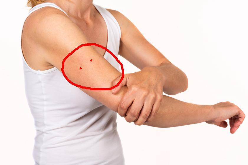 Болят мышцы руки от плеча до локтя: причины, диагностика и лечение