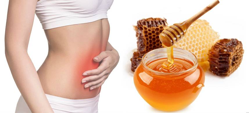 Мед при гастрите - можно или нет? народный рецепт лечения с повышенной кислотностью желудка и язве