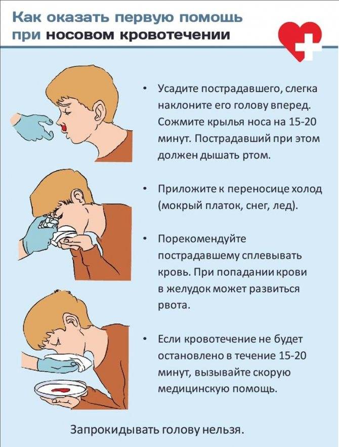 Кровь из носа у ребенка при насморке
