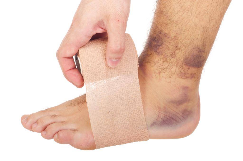 Как долго носить гипс при переломе пальца ноги