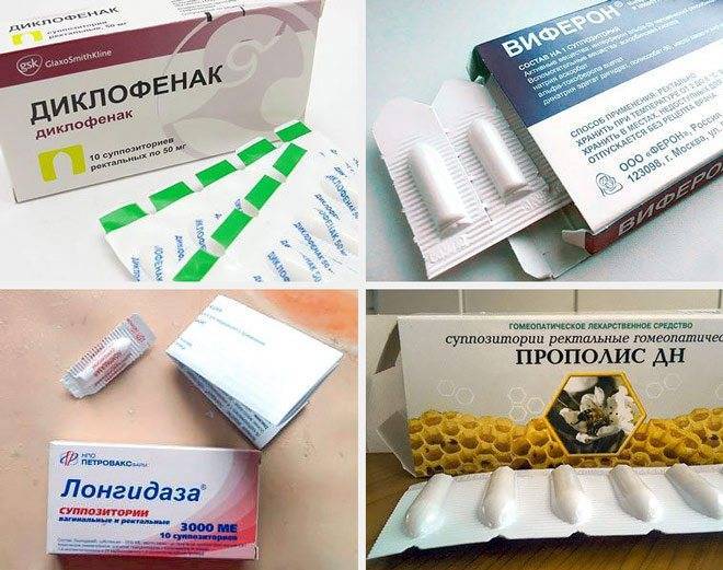 Причины, симптомы и лечение воспаления придатков у женщин | симптомы и лечение урогенитальных заболеваний – noprost.ru