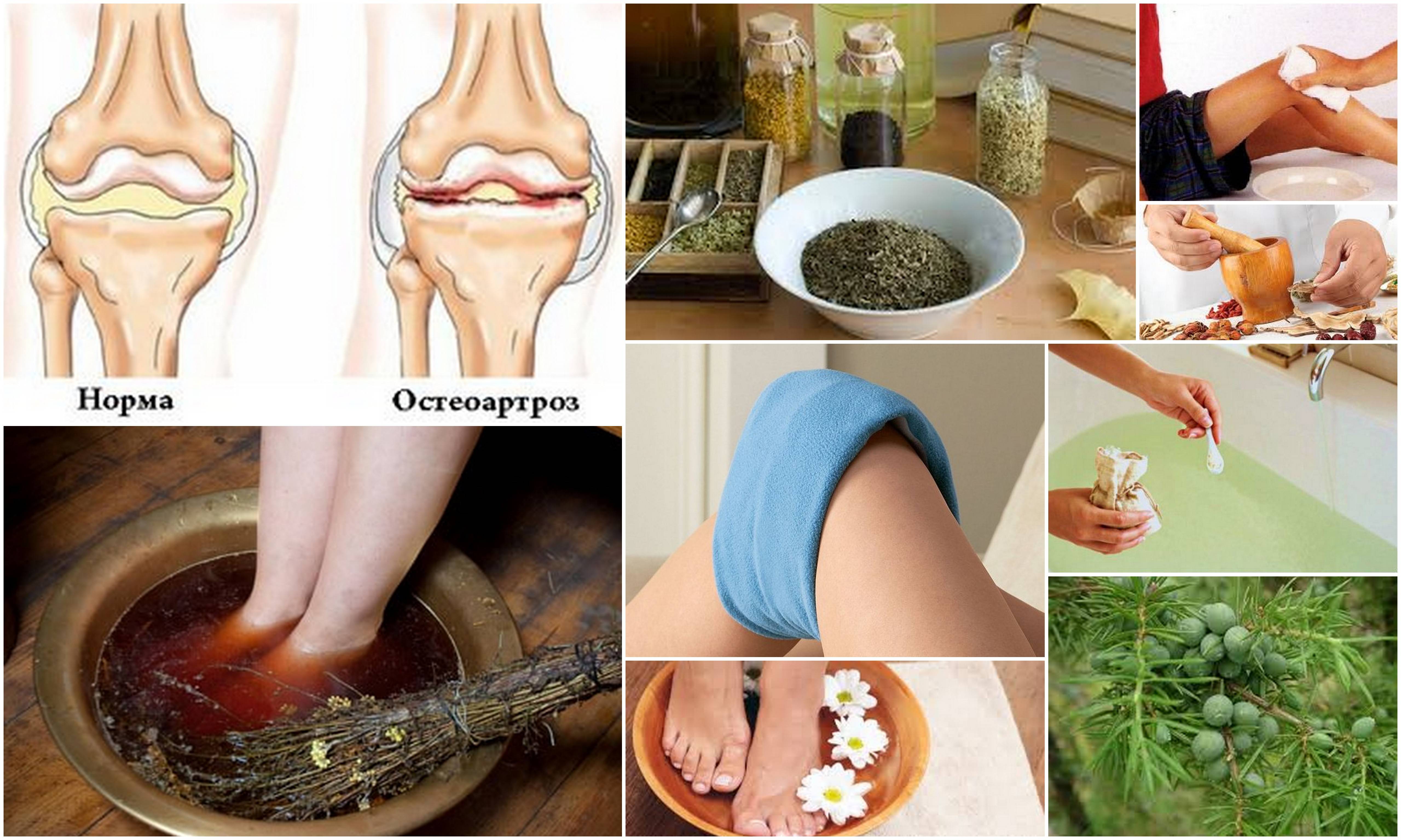 Лечение народными средствами, если болят колени, как лечить боль в домашних условиях