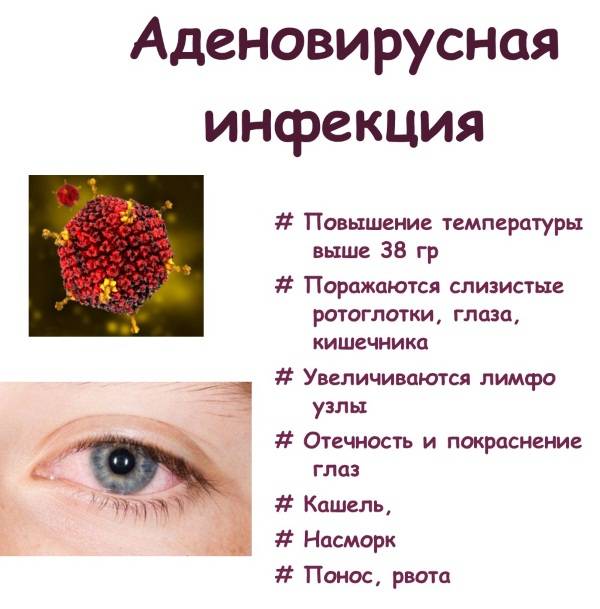 Аденовирусная инфекция симптомы у взрослых и лечение