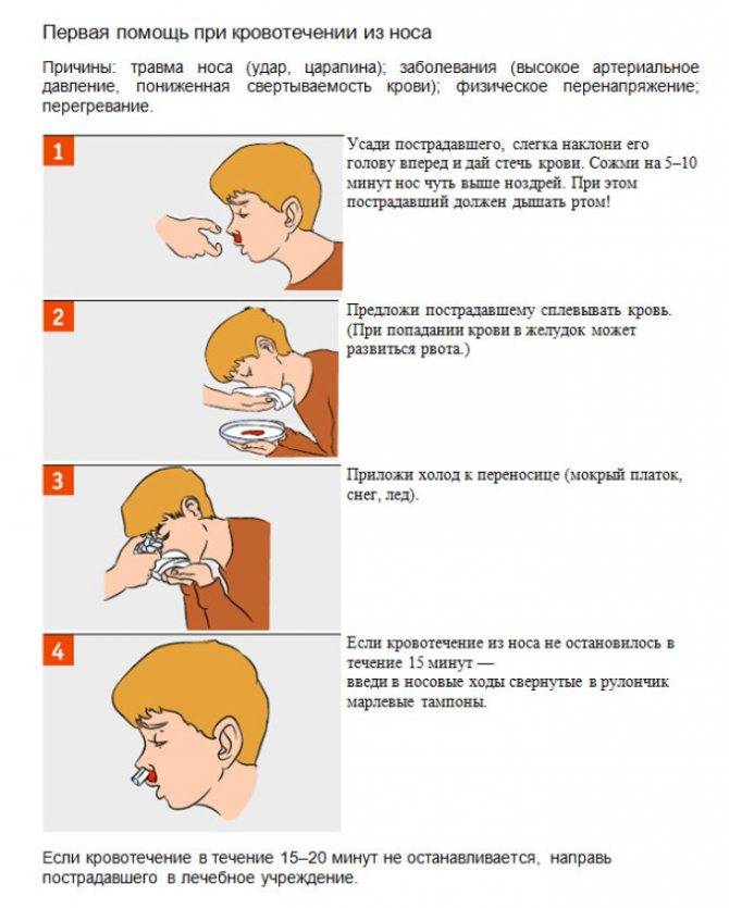 Как остановить кровь из носа: правила оказания первой помощи