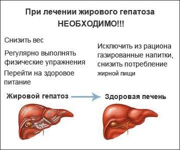 Жировой гепатоз печени | лечение и питание