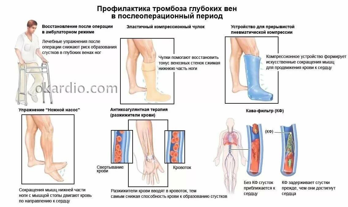 Тромбоз: разжижение крови народными средствами, лечение тромбов в венах на ногах