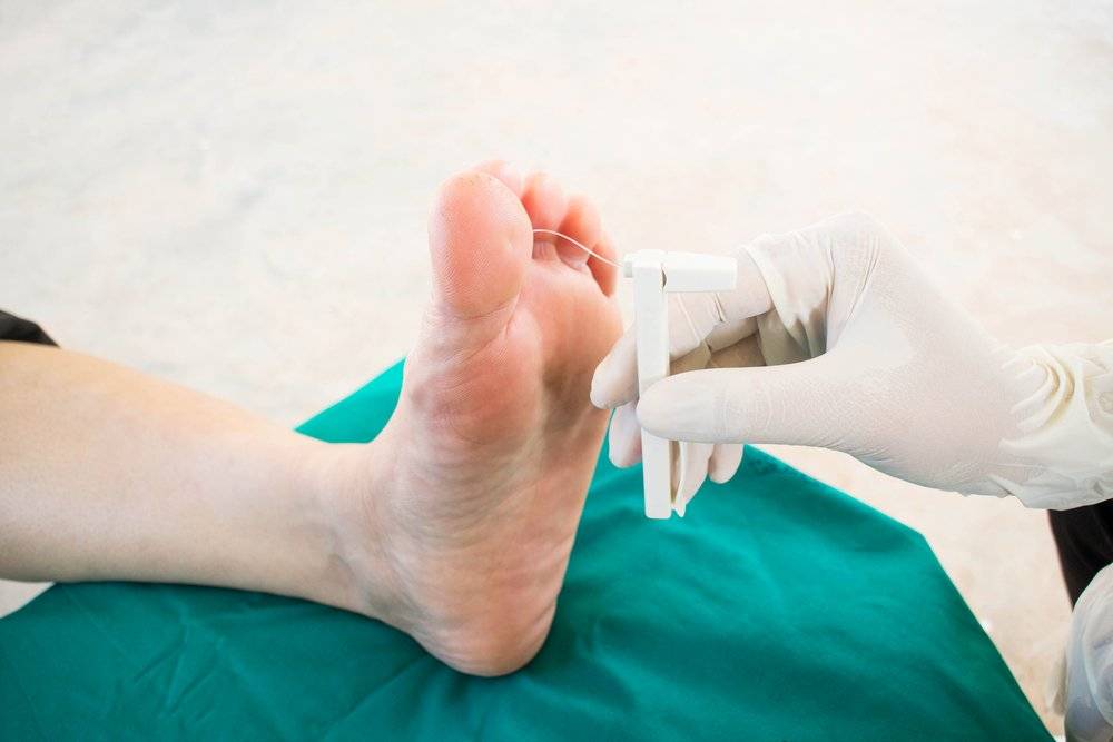 Гангрена ноги - признаки, причины, вопросы, лечение без ампутации