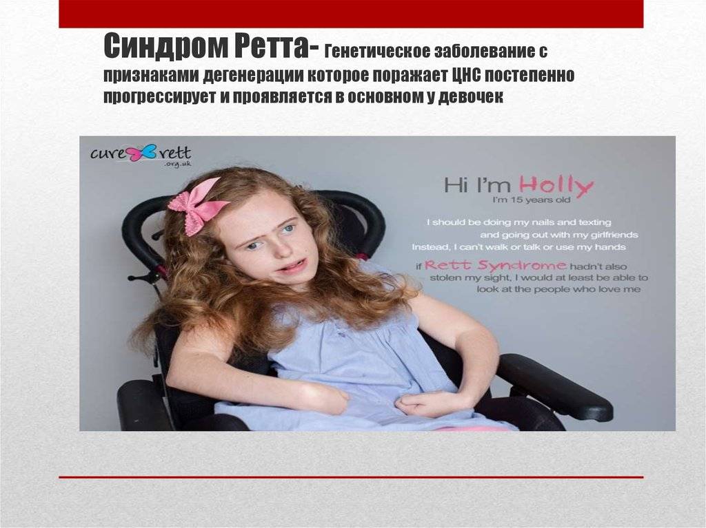 Синдром ретта у детей: что это такое, симптомы | prof-medstail.ru