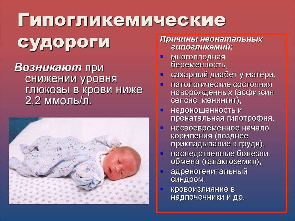 Синдромы при эпилепсии. Проявление судорожного синдрома. Судороги у новорожденных детей. Причины возникновения судорожного синдрома. Судорожные припадки у новорожденных.