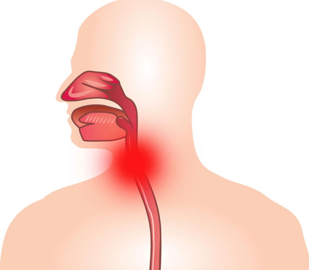Жжение и неприятные ощущения во рту и на языке: причины и лечение