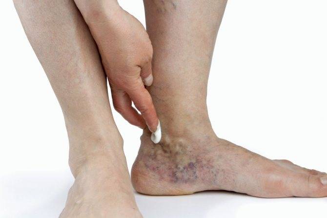 Болят ноги от бедра до стопы: причины и лечение болей, что делать