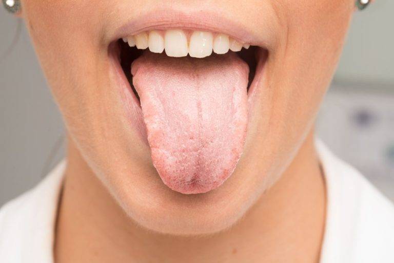 Сухость во рту при гастрите - причины данного симптомы