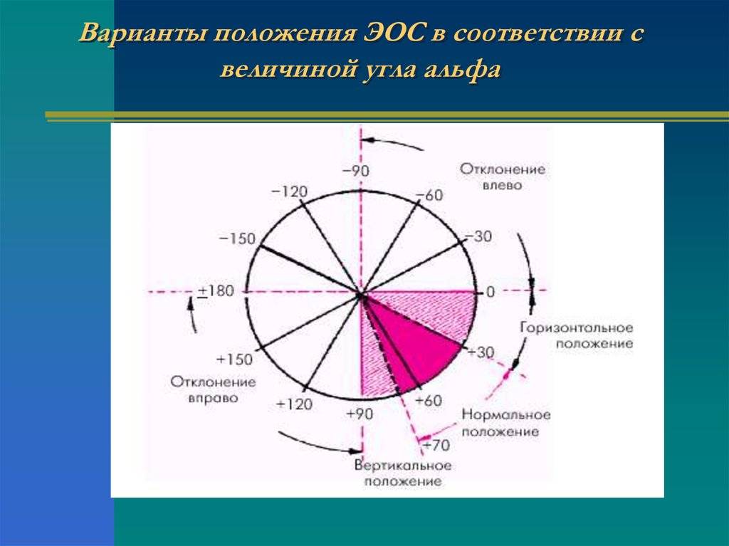 Оси сердца рисунок