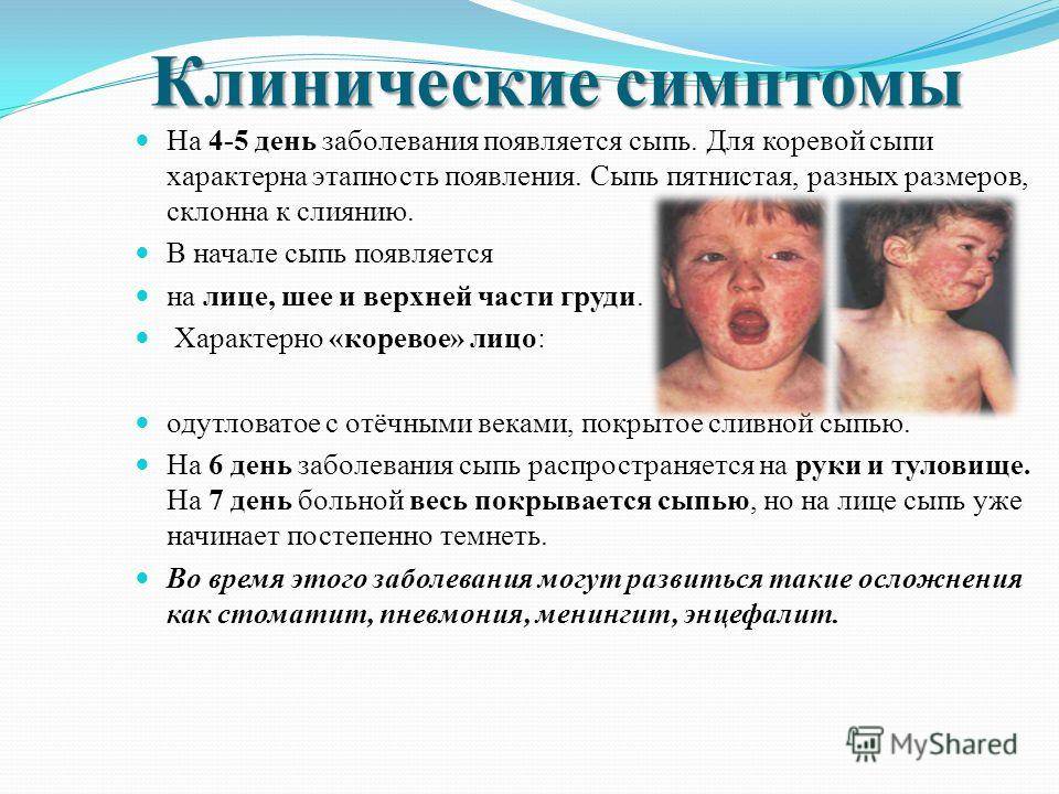 Особенности серозного менингита у детей: симптомы, инкубационный период, лечение