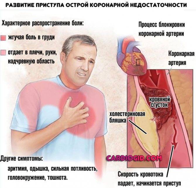 Боль в грудине посередине и комок в горле: причины и лечение