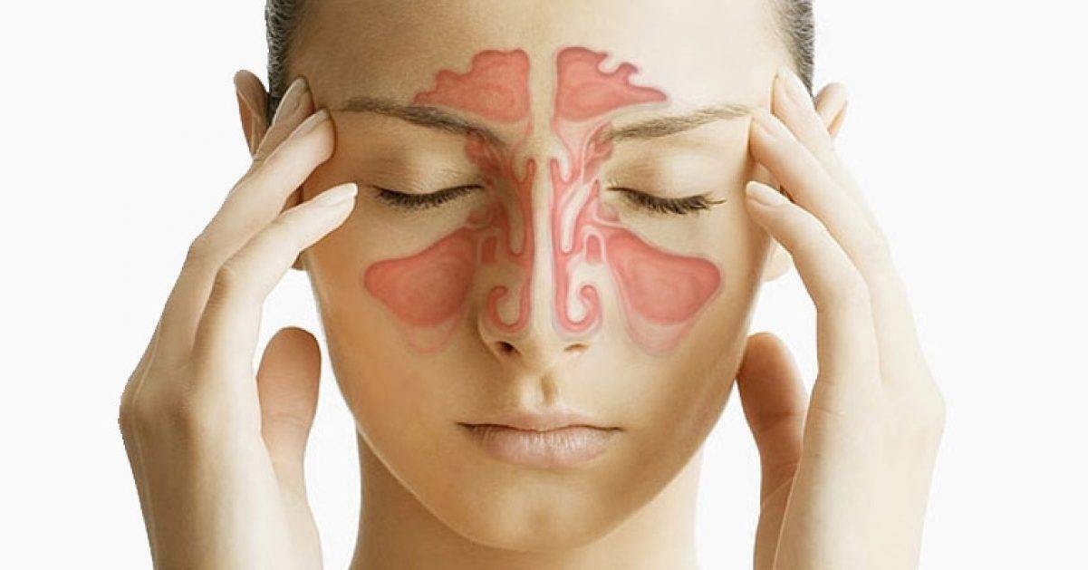 Отек носа без насморка: причины и лечение у взрослых и детей