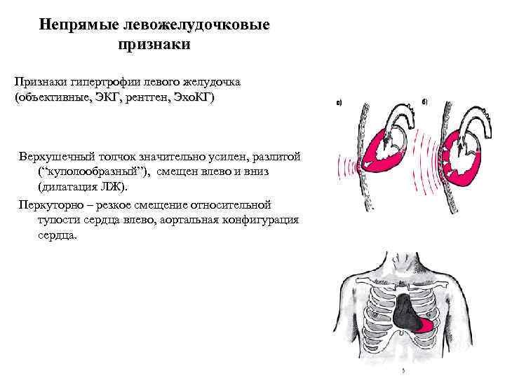 Синдром артериальной гипертензии пропедевтика