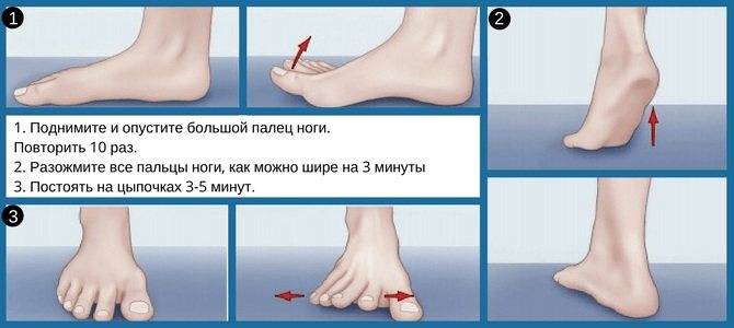 Перелом пальцев ноги