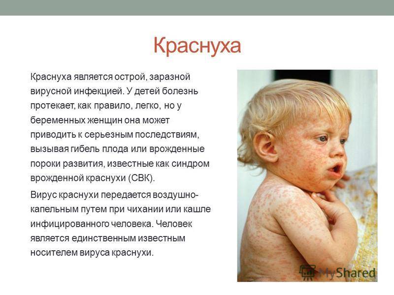 Какие болезни в детстве. Сыпь корь краснуха сыпь. Краснуха и корь у детей информация.