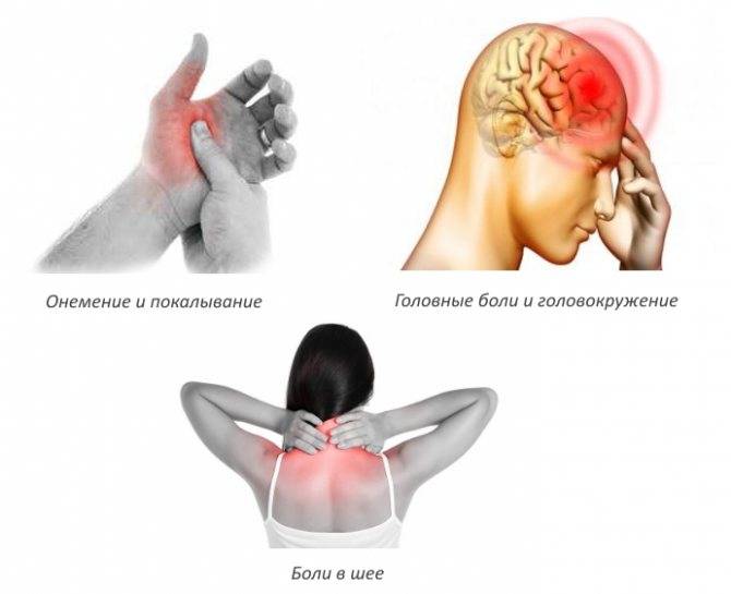 Онемение и отеки лица при шейном остеохондрозе: причины, лечение, профилактика