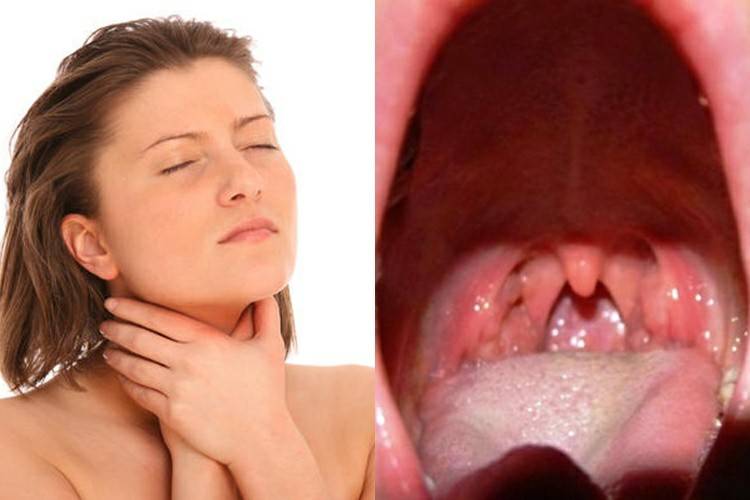 Чем лечить боль в горле при глотании без температуры: лучшие препараты и на...