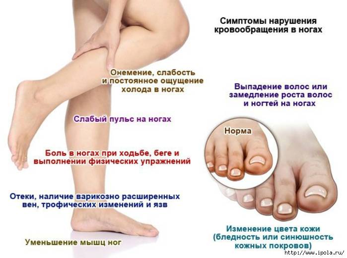 Онемение ног и рук | по какой причине немеют ноги и руки и что делать? | компетентно о здоровье на ilive