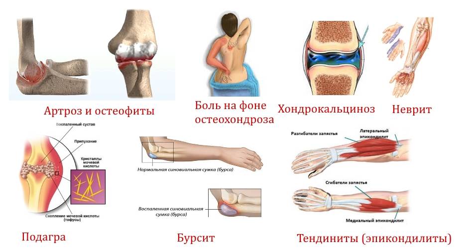 Боль в локтевом суставе с внешней стороны руки: причины и лечение