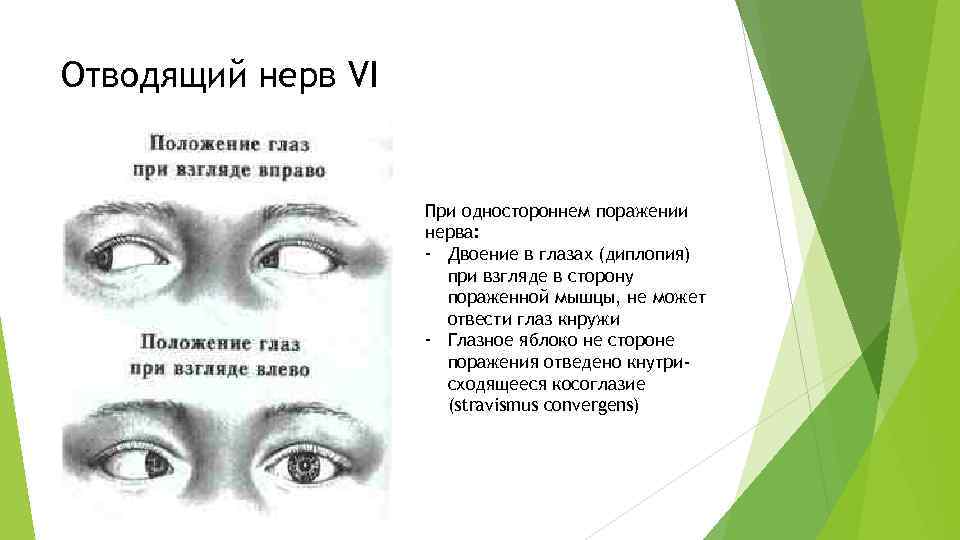 Причины нечеткого зрения: временные явления, болезни глаз, лечение, видео сайт «мы о здоровье»
