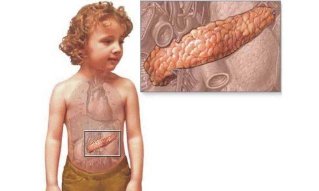Заболевания поджелудочной железы у детей: симптомы проблем, болезни у ребенка