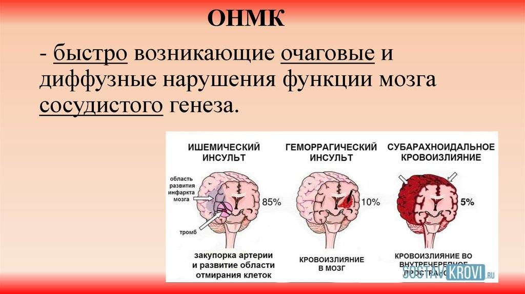 Витамины при энцефалопатии головного мозга