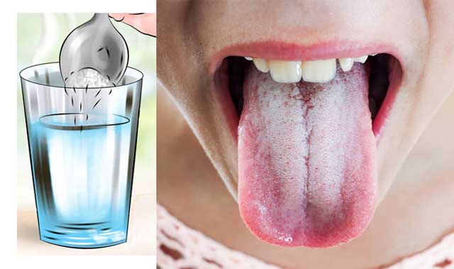 Щиплет и болит кончик языка: причины и лечение почему возникает пощипывание и какое это может быть заболевание?
