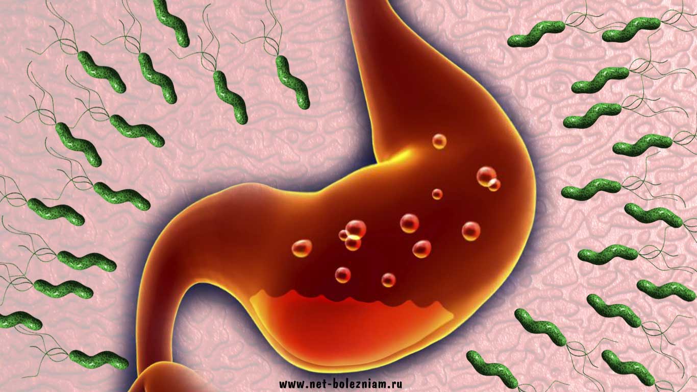 Бактерия гастрита: причина и лечение helicobacter pylori