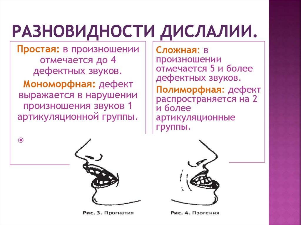 Сенсорная и моторная дислалия