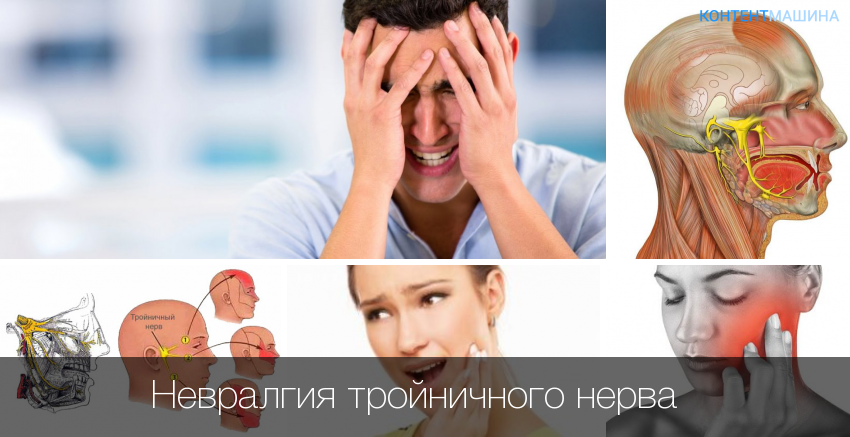 Воспаление лицевого нерва (невралгия, невропатия или парез): симптомы и лечение