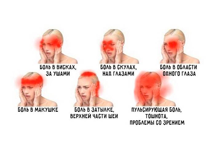 Боль в висках и лобной части головы: причины и заболевания, диагностика, лечение