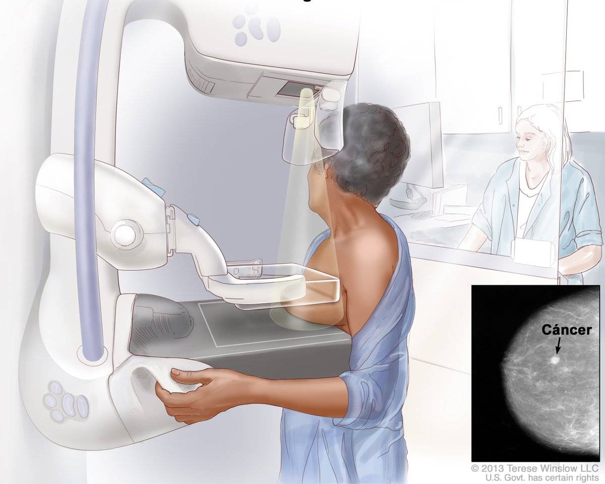 Пройти маммографию платно. Маммограф MTL. Рентген молочных желез маммография аппарат. Томосинтез молочных желез аппарат. Томосинтез рентгеновский аппарат.