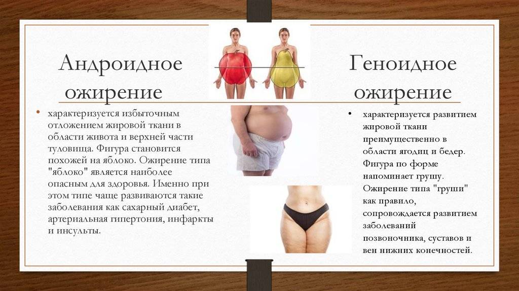 Отеки и лишний вес. Ожирение типы ожирения. Андроидный Тип ожирения. Типы ожирения у женщин. Типы отложения жира.