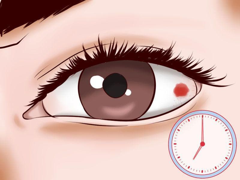 Народные средства от конъюнктивита: рецепты с алоэ для лечения воспаления глаз у взрослых